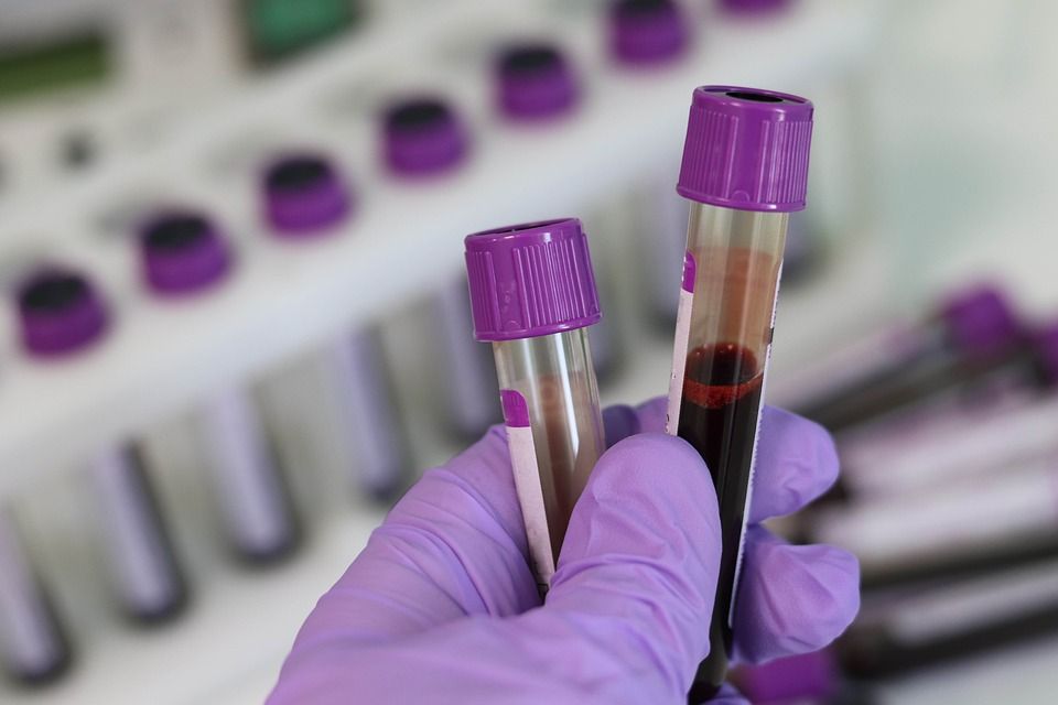 Un nou test de sânge pentru cancerul de prostată ar putea reduce biopsiile inutile