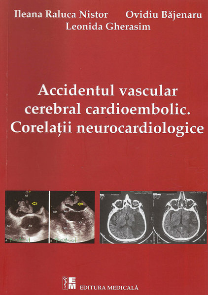 Corelații neurocardiologice în accidentul vascular embolic