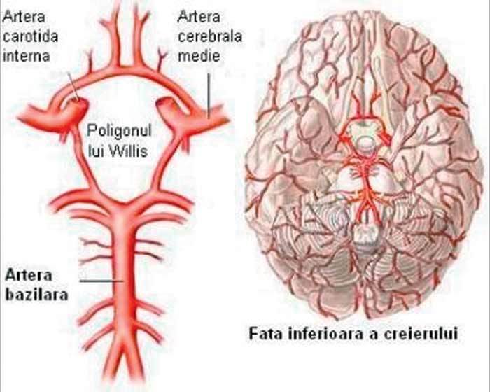 Stenoza aterotrombotică de arteră carotidă. Consideraţii terapeutice