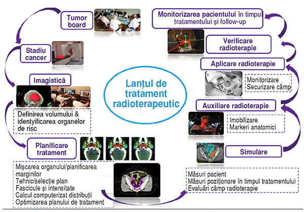 Condiţii pentru succesul unui program de radioterapie