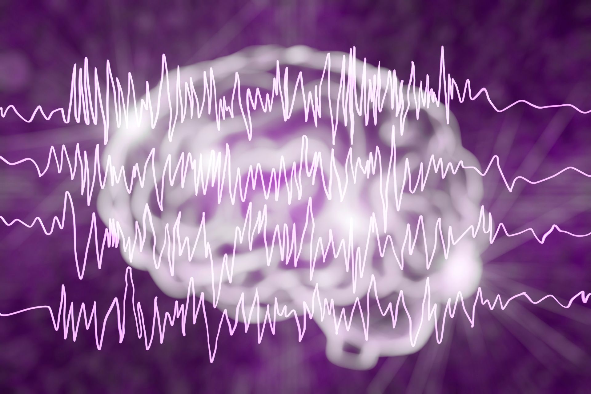 stigmatizare-epilepsie