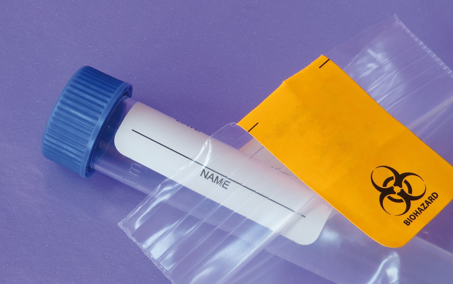 Un nou test de salivă  aprobat de FDA pentru depistarea SARS-CoV-2