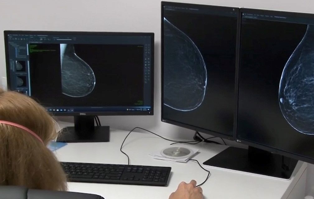 mamografie-timisoara