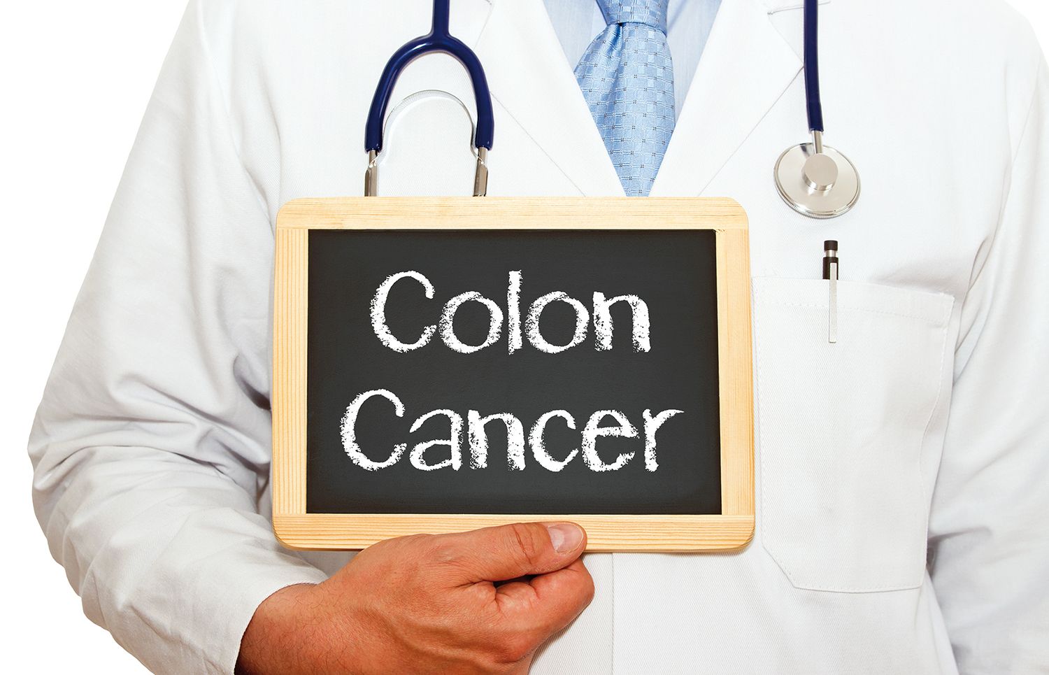 Recomandări pentru screeningul cancerului colorectal