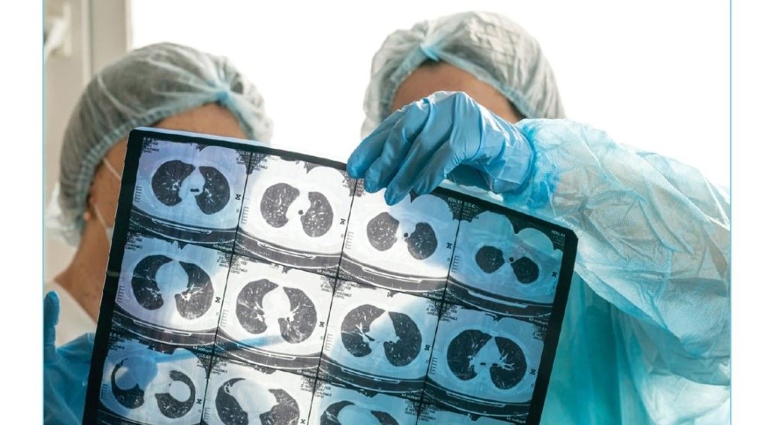 Radiografii pulmonare și consultații gratuite pentru locuitorii Sectorului 1