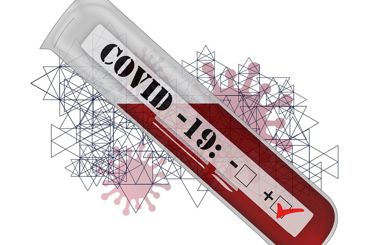 Testele rapide antigen nu reprezintă un instrument fiabil pentru diagnosticarea COVID-19