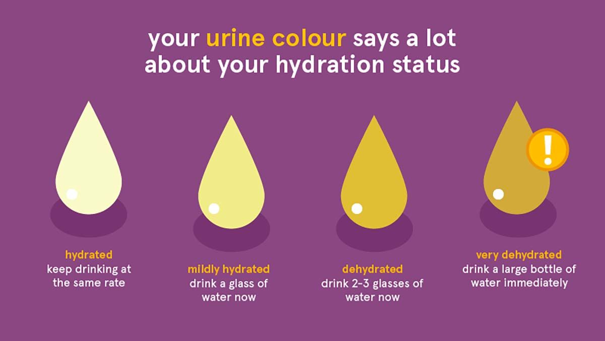 urine_colour