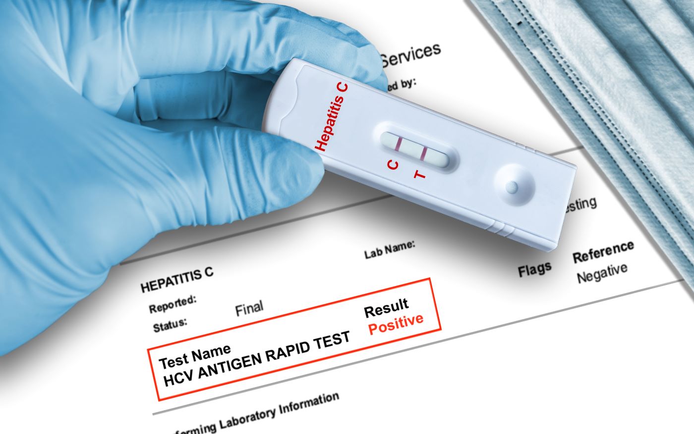 Primul autotest pentru diagnosticarea hepatitei C, precalificat de OMS 