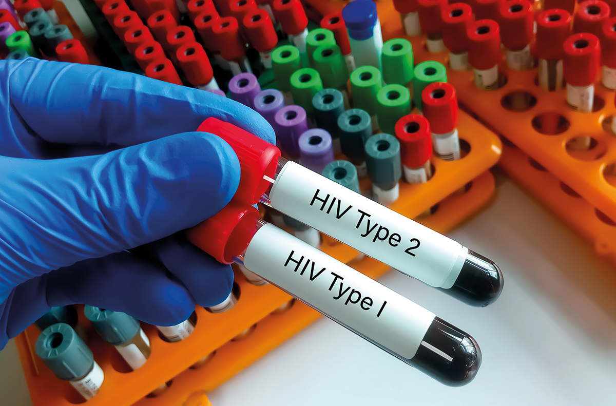 De unde vă puteți comanda un autotest HIV gratuit