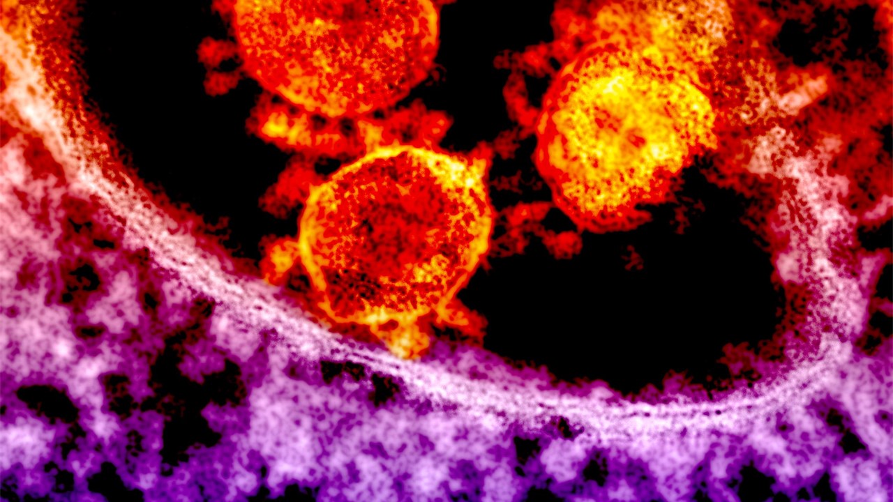 Un bărbat a fost diagnosticat cu virusul MERS-CoV