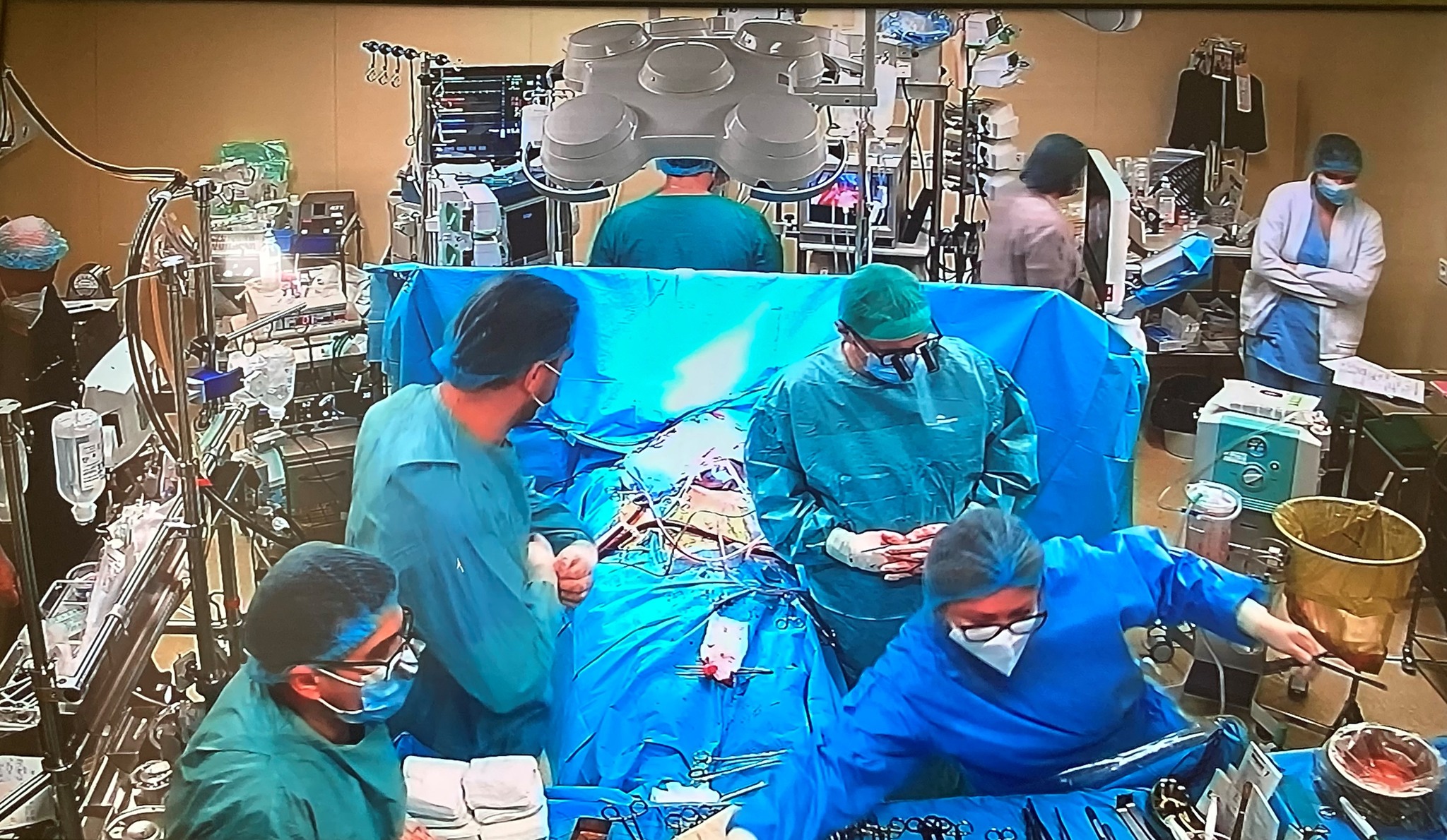 O nouă operație de transplant cardiac la Spitalul Clinic de Urgență București